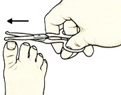 Ногти на ногах следует обрезать прямо, чтобы во взрослом возрасте они не врастали в мягкие ткани