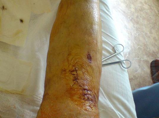 Фото для Требуются средства для восстановления после аварии