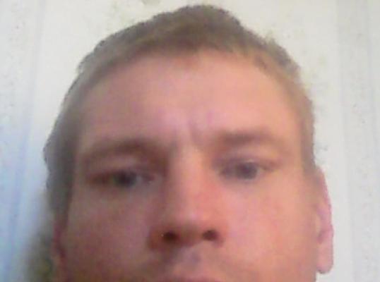 Фото для Нужны деньги для лечения туберкулеза народными средствами, таблетки не помогают