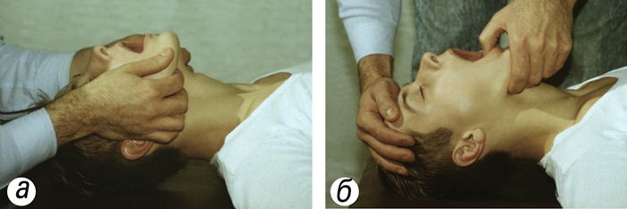 Подготовка к проведению искусственного дыхания: выдвигают нижнюю челюсть вперед (а), затем переводят пальцы на подбородок и, оттягивая его вниз, раскрывают рот; второй рукой, помещенной на лоб, запрокидывают голову назад (б).